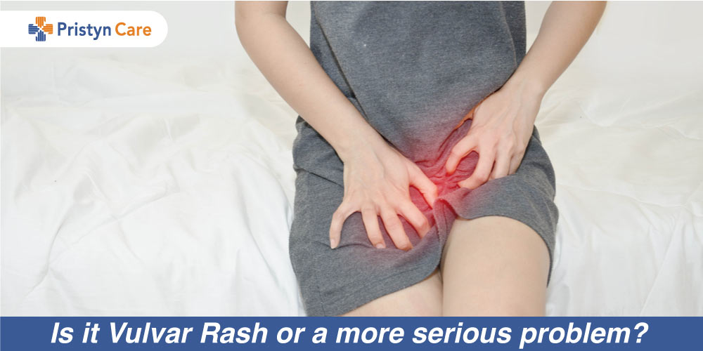 Is it Vulvar Rash or a more serious problem?