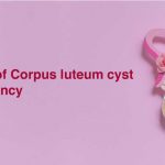 corpus luteum cyst in pregnancy