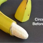Circumcision-Before-And-After