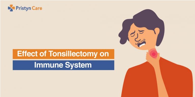 Effects of Tonsillectomy on Immune System