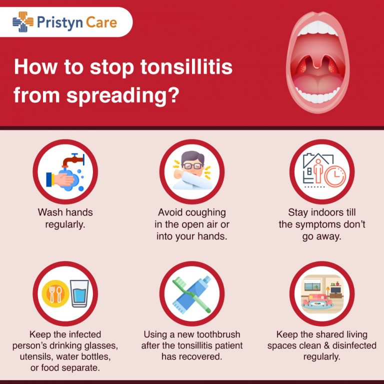 Is Tonsillitis Contagious? - Pristyn Care