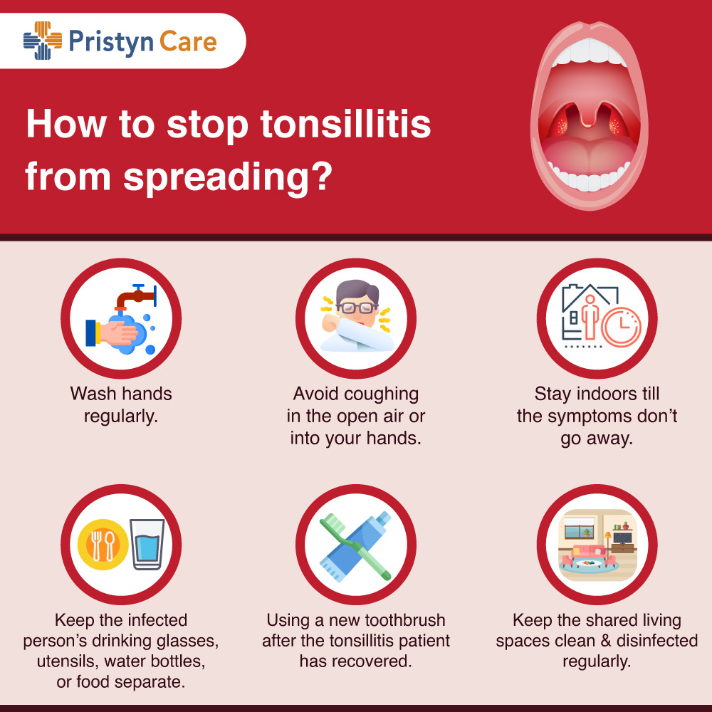 How-to-stop-tonsillitis-from-spreading