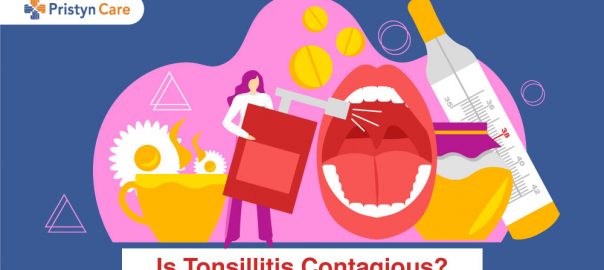 Is Tonsillitis Contagious?