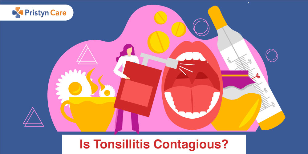 Is tonsillitis contagious