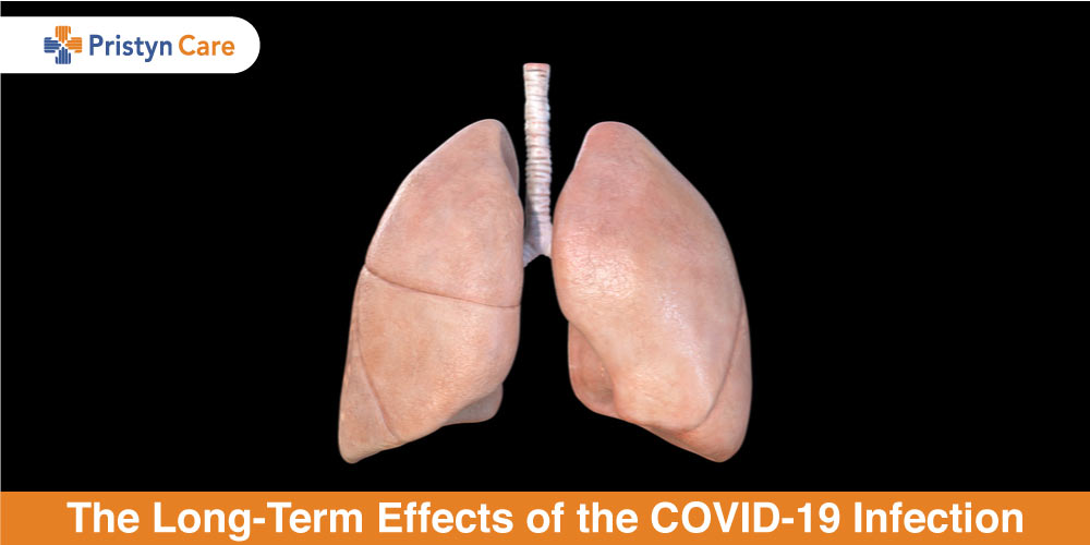 The LongTerm Effects of the COVID19 Infection Pristyn Care