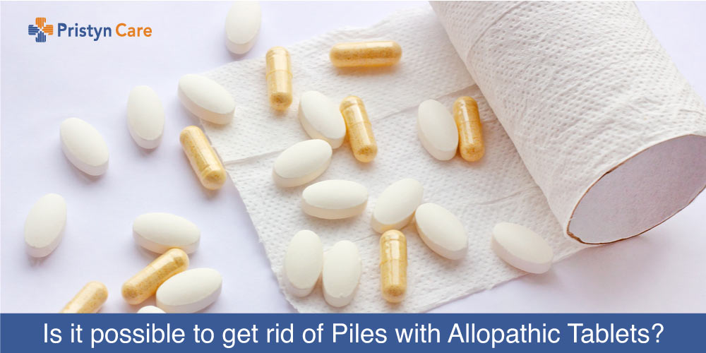 Is it possible to get rid of Piles with Allopathic Tablets?
