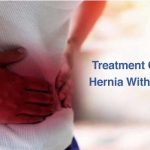 Treatment of Umbilical Hernia Without Surgery
