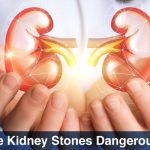 are kidney stones dangerous