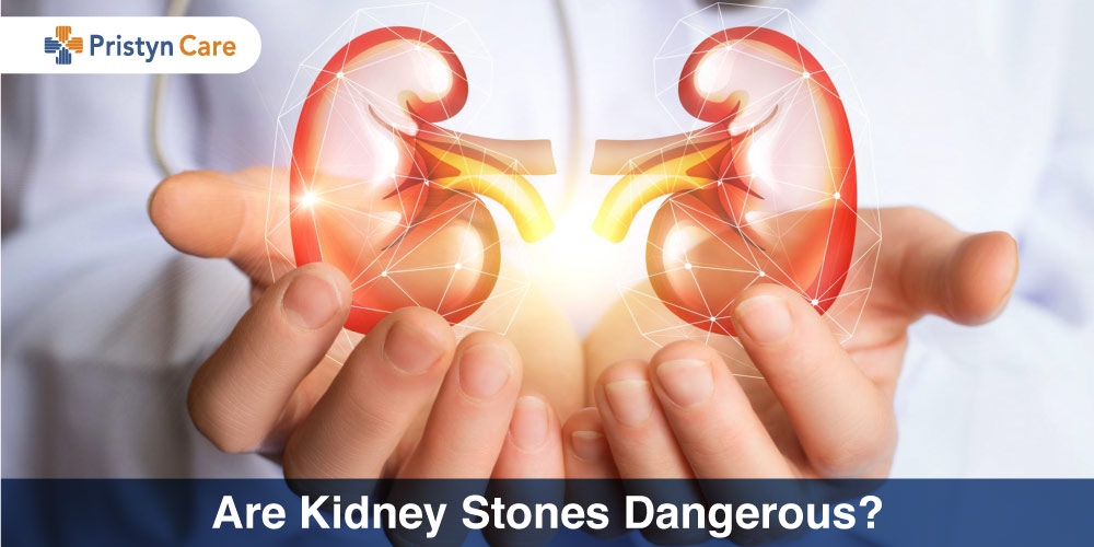 are kidney stones dangerous