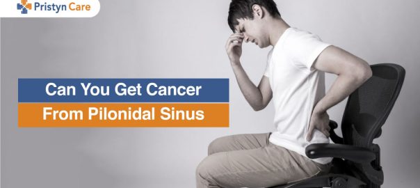 Can You Get Cancer From Pilonidal Sinus?