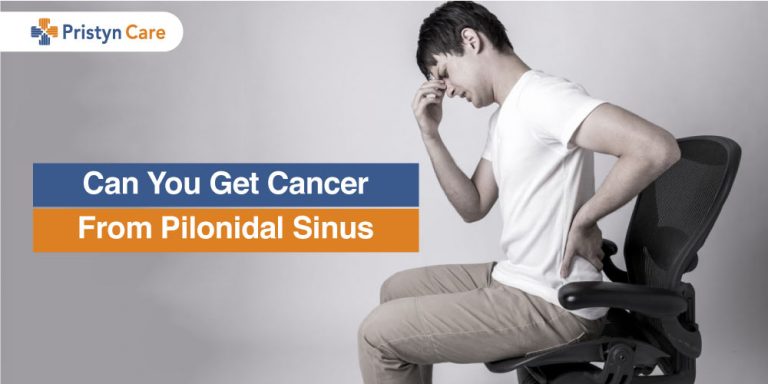cancer from pilonidal sinus