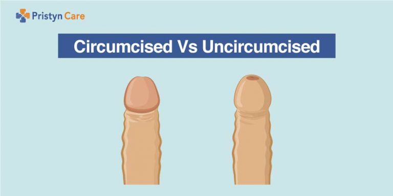 circumcised vs uncircumcised