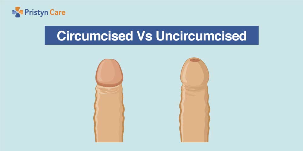 circumcised vs uncircumcised