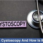 cystoscopy