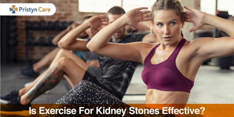 exercise for kidney stones