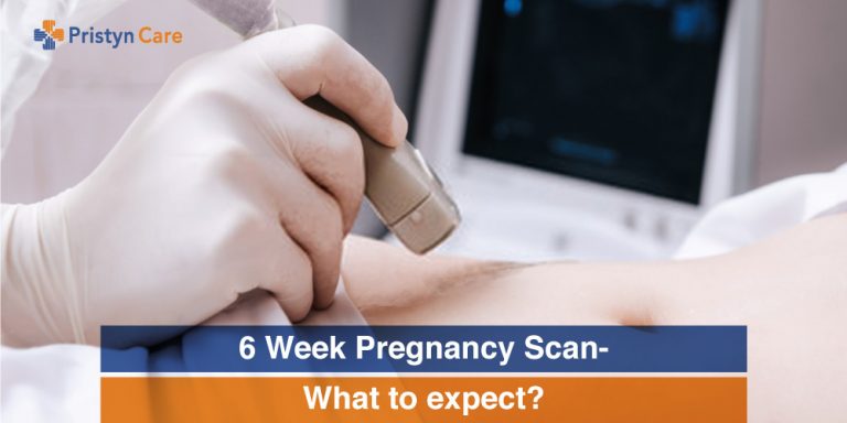 6 Week Pregnancy Scan- What to expect?