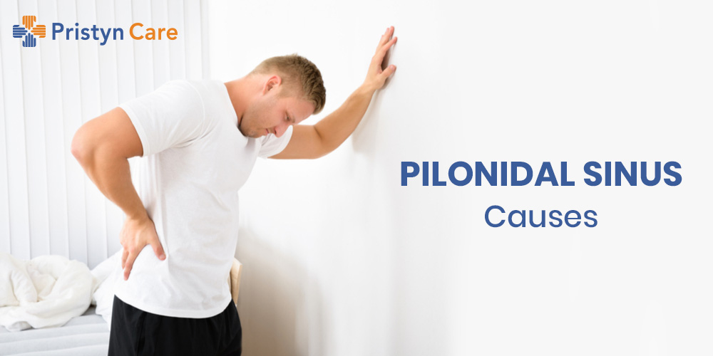 pilonidal sinus causes