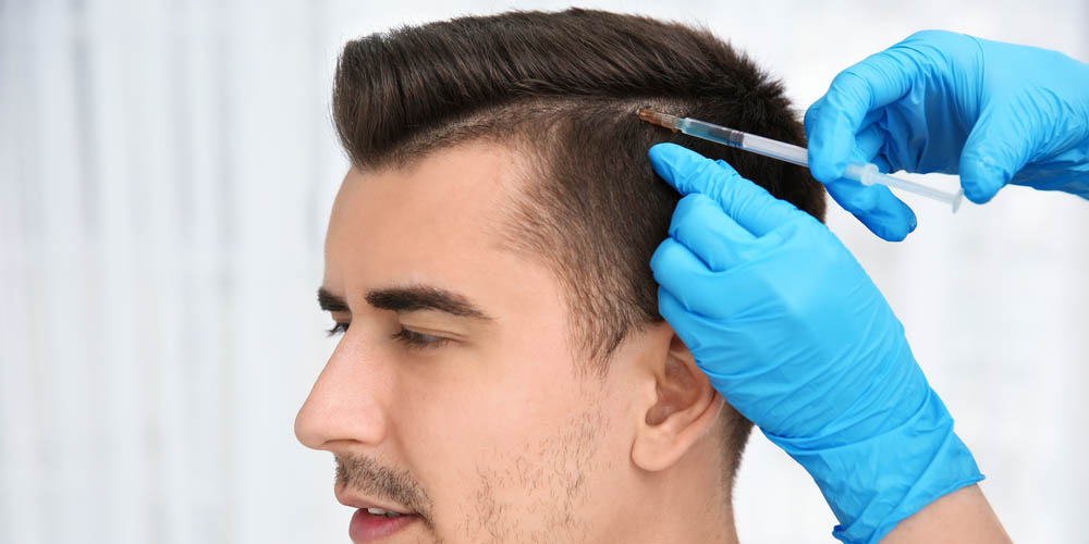 Best results of hair transplantation