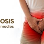 man having phimosis- tight foreskin