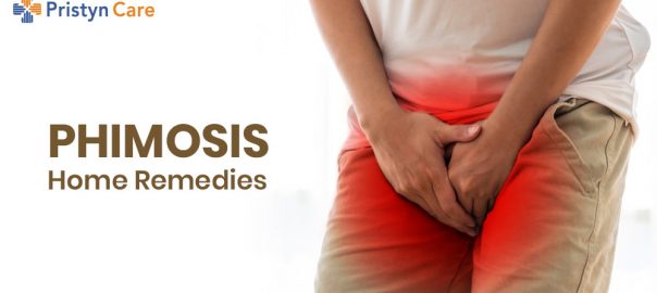 Phimosis Home Remedies