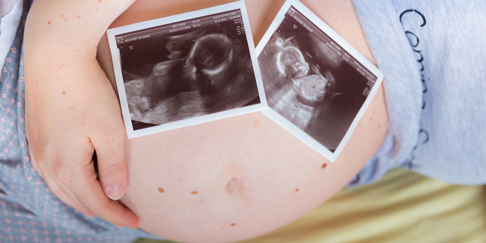 pregnant female having twins
