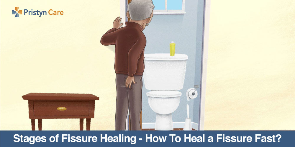 Stages of Fissure Healing - How To Heal a Fissure Fast?