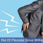 treat pilonidal sinus without surgery