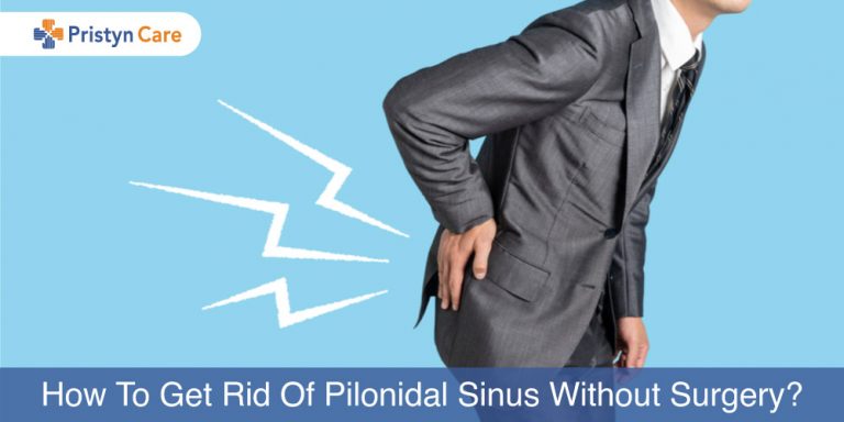 treat pilonidal sinus without surgery