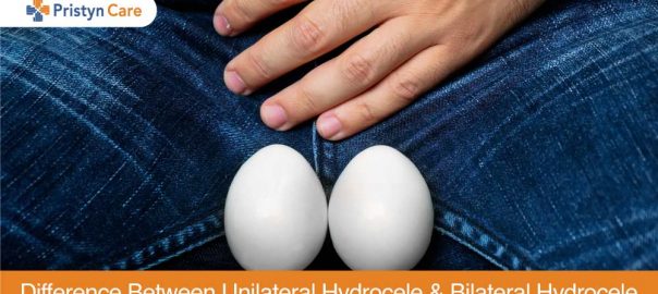 Difference Between Unilateral Hydrocele And Bilateral Hydrocele