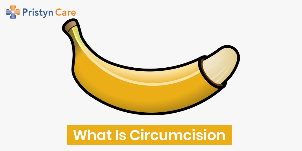 what is circumcision