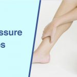 Acupressure Points for Piles