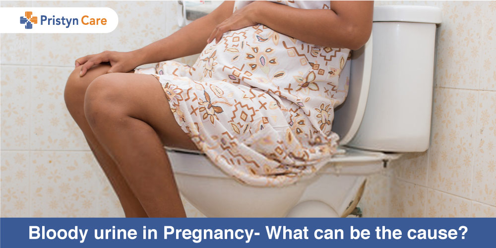 Bloody urine in Pregnancy- What can be the cause?