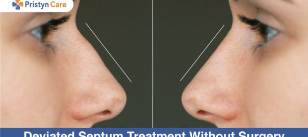 Deviated Septum Treatment Without Surgery | 10 Remedies To Try At Home