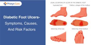 Diabetic-Foot-Ulcers--Symptoms,-Causes,-And-Risk-Factors