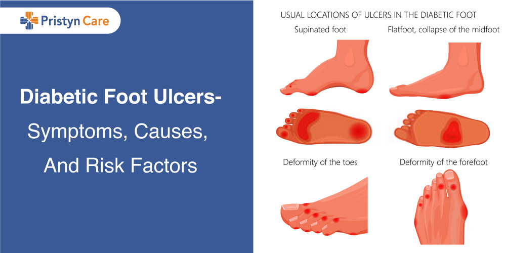 the diabetic foot)