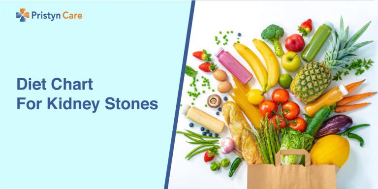 Diet-Chart-For-Kidney-Stones