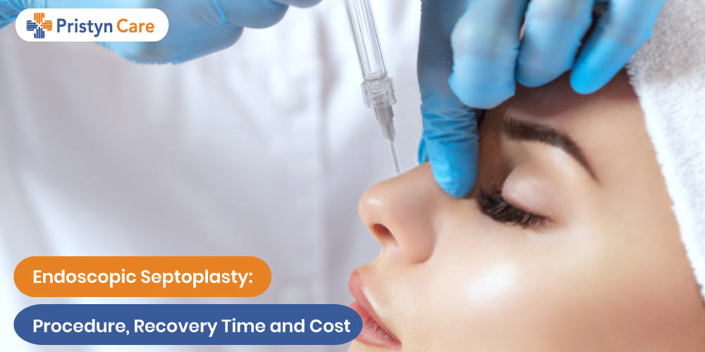 Endoscopic Septoplasty