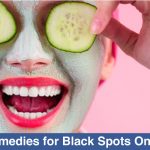 Home-Remedies-for-Black-Spots-On-The-Skin