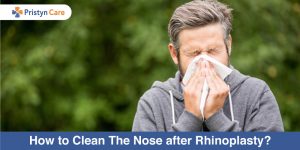 How-to-Clean-The-Nose-after-Rhinoplasty