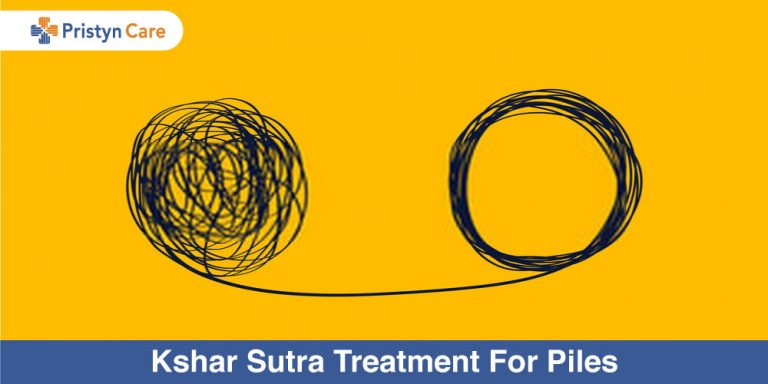 Kshar Sutra Treatment for Piles