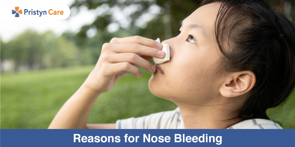 Reasons for Nose Bleeding Pristyn Care