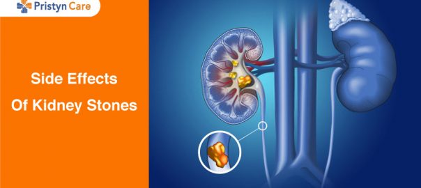 Side Effects Of Kidney Stones