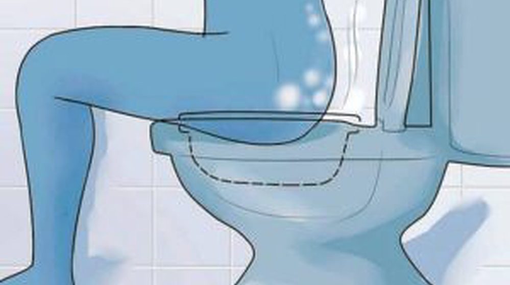 Sitz bath kit on toilet seat