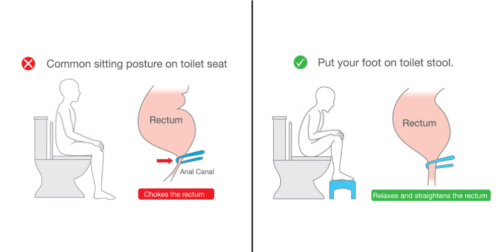 Squatting while defecation