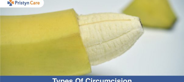Types Of Circumcision