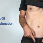 Types-Of-Erectile-Dysfunction