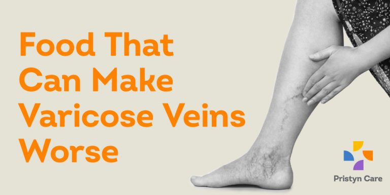 food that can make varicose veins worse