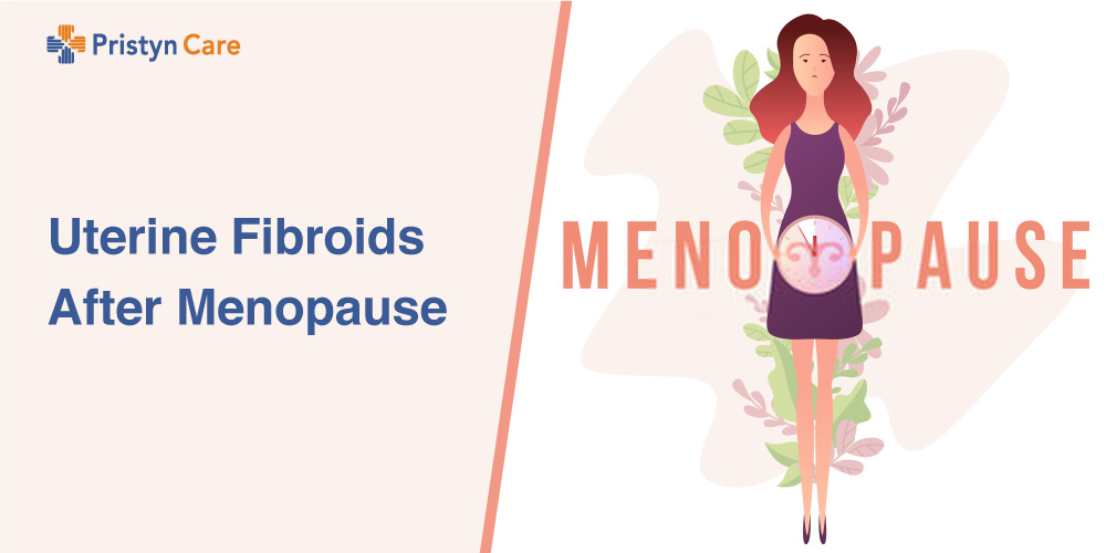 Uterine Fibroids After Menopause Pristyn Care