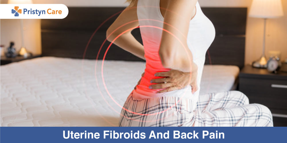 Uterine-Fibroids-And-Back-Pain