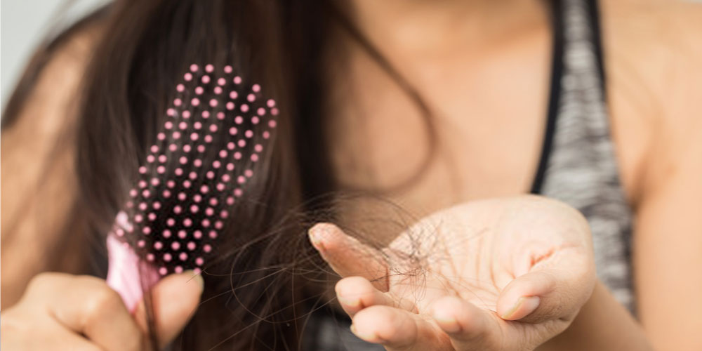 Hair fall of a woman